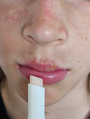 Skin care routine highlights the importance of lip treatment for hydration