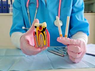 Educational demonstration of dental health highlighting the impact of smoking on teeth and gums...