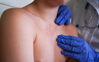 The physician is examining the boy for symptoms of smallpox-like illness.