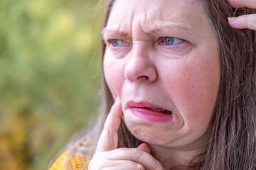 Suffering woman in pain touching jaw, toothache, painful tooth, gum swelling, worried expression,...