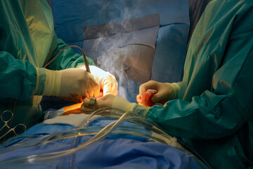 Two surgeons focused on performing surgery in operating room. Serious atmosphere filled with...