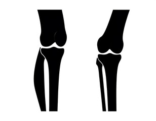 Knee bone diagram