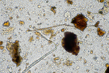 microorganisms and soil biology, with nematodes and fungi under the microscope.