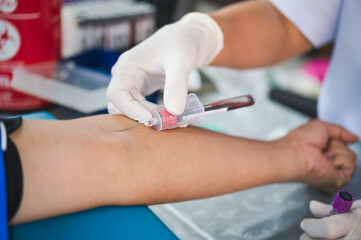 Close up hand of nurse, taking blood sample from a patient in the hospital.	