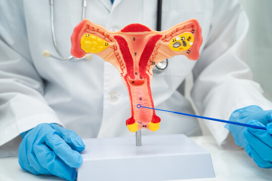 Doctor holding human uterus model for vaginal and cervix pap smear check up in the obstetrics and gynecology.