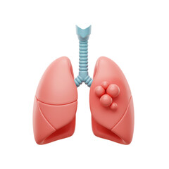 A detailed anatomical illustration showcases the human respiratory system with one lung affected by a cluster of abnormal growths.