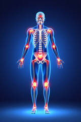 Full Body Illustration Highlighting Joint Pain from Arthritis