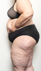 Frau zeigt ihre Cellulite, Thema Abnehmen und Diät