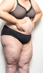 Frau zeigt ihre Cellulite, Thema Abnehmen und Diät