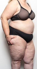 Frau zeigt ihre Cellulite, Thema Abnehmen und Diät
