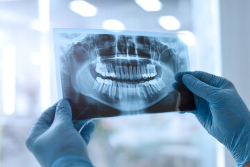 Doctor examines dental X-ray. Dentist studies radiography scan in clinic. For medical, dental, healthcare marketing, design, web.