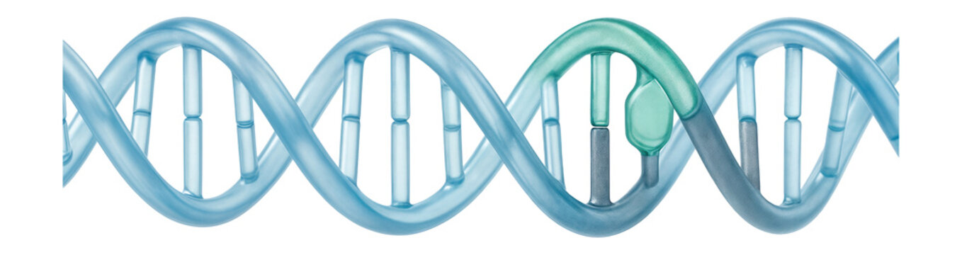 Single nucleotide polymorphism (SNP) with adenine replaced by guanine on a DNA strand
