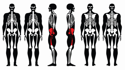 A clear and educational visual breakdown of the human skeleton from multiple perspectives, enhanced by muscle group highlights on the gluteal and posterior thigh regions. This diagram presents six ana