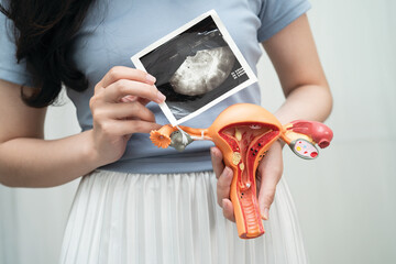 Uterus ultrasound, Asian woman holding human anatomy model.