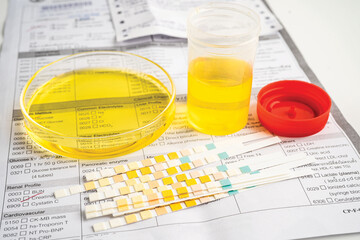Urinalysis, urine cup with reagent strip pH paper test and comparison chart in laboratory.