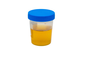 Urine sample