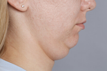 Obraz premium Woman with double chin on grey background, closeup