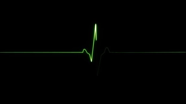 Cardiac arrest on the medical monitor, heart stops beating. Heart beating then hearts deadline on black background. Seamlessly loop footage.