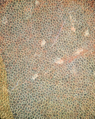 Tomatenhaut unter dem Mikroskop - Dunkelfeld  10x-Vergrößerung