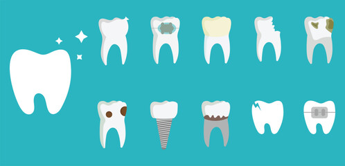 vector illustration of tooths. Vector illustration of healthy teeth and various dental problems, ideal for medical and educational use.