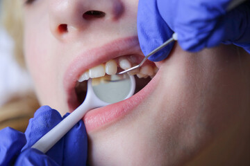Doctor is preparing for examination of child teeth with tools.