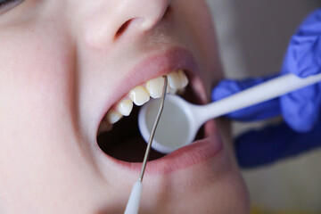 Doctor is preparing for examination of child teeth with tools.