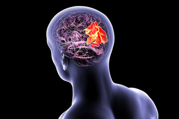 Human brain with highlighted precuneus gyrus, 3D illustration