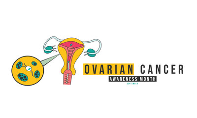 Ovarian Cancer Awareness Month. Ovarian Cancer Concept Design Background.