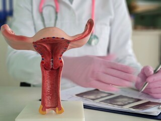 Medical expert demonstrates female reproductive anatomy with a detailed model