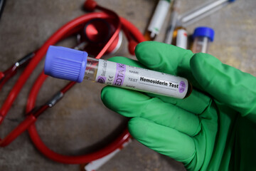 Hemosiderin Test with blood sample in green gloved hands. healthcare and pharmaceutical concept