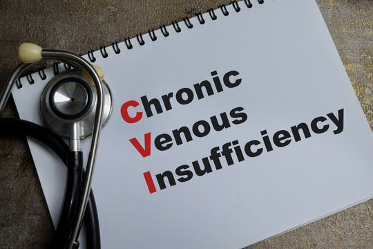 Concept of CVI - Chronic Venous Insufficiency write on book isolated on Wooden Table. healthcare and pharmaceutical concept
