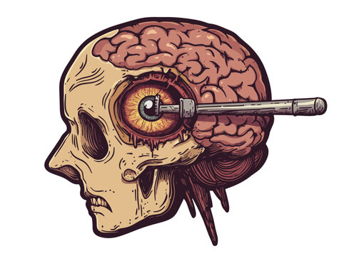 Modern illustration of neurosurgical treatment in brain diagram schematic, including leucotomy and lobotomy, for medical science education