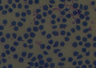 blood serum under microscope. full frame