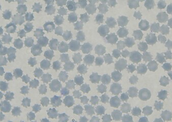 blood serum under microscope. full frame
