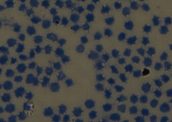 blood serum under microscope. full frame