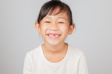 Dentist explains tooth loss to happy Asian kid girl, smiling with tooth gap. Child shows missing tooth, learning dental care and natural process of growing new teeth. isolated white background