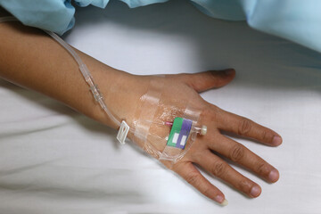 Medical IV drip on a patient’s hand in a hospital setting