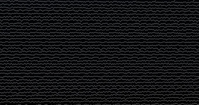 Graphic lines running in black background. Loop