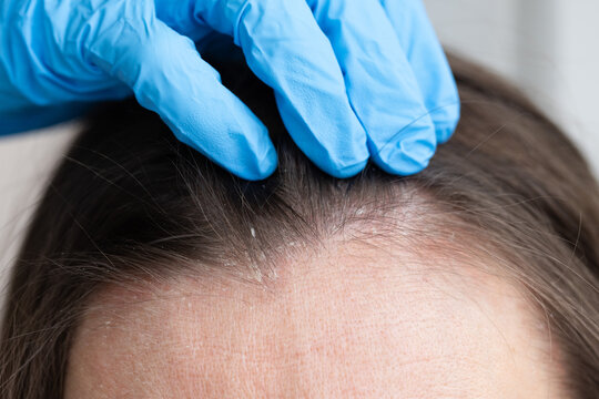 An appointment with a trichologist.