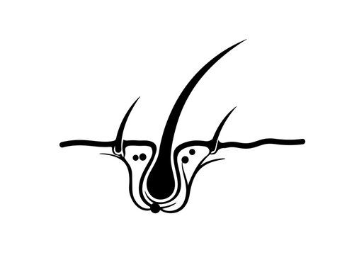 A black and white illustration of a hair follicle with hair shafts and sebaceous glands visible