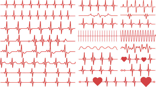 Various red ekg heart beat patterns on a white background showing different heart conditions and rhythms silhouette