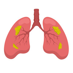 Vector illustration of lung organ theme affected by cancer tissue on white background