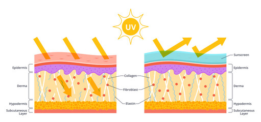 Sun protection skin scheme. Uv rays arrow penetrating, collagen destruction, structure damage, use lotions and creams, sunscreen protection, medical banner, nowaday vector isolated concept