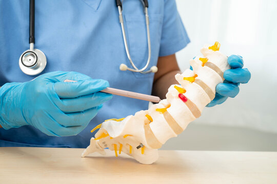 Asian doctor holding spinal nerve and bone model, Lumbar spine displaced herniated disc fragment for treatment medical in the orthopedic department.