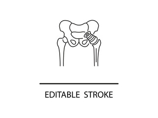 Hip replacement illustration showing joint implant for medical designs and orthopedic visuals, perfect for healthcare materials and anatomy studies.
