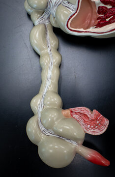 Colon Model Illustrating Spastic Colon And Segmental Contraction Patterns