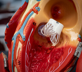 Heart Anatomical Model Showing Bicuspid Mitral Valve And Aortic Valve Interior