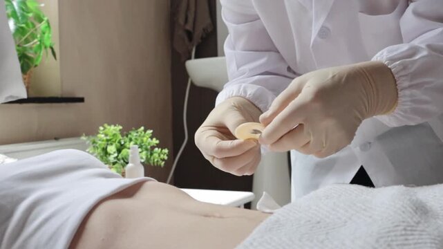 A nurse applies a base to a patient's abdomen to accommodate a colostomy bag.