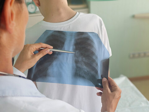Doctor examining chest X-ray of child in clinic to assess respiratory health concept - Powered by Adobe
