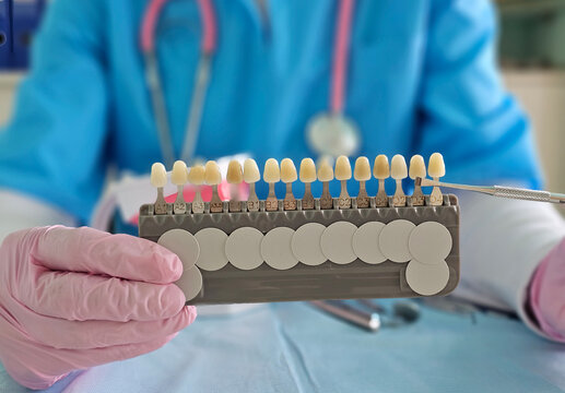 Dental professional demonstrates shade guide for tooth color matching in clinic